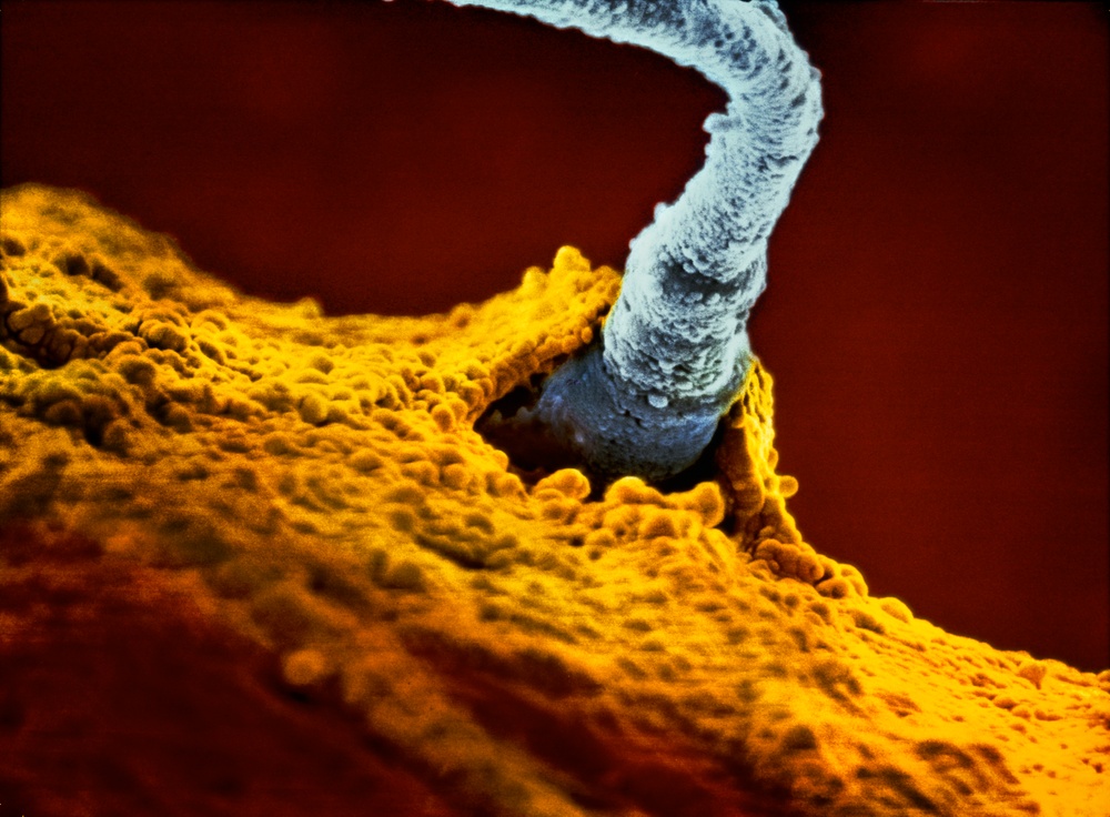 Befruktningen – en spermie tar sig in i ägget. ©Lennart Nilsson/TT Nyhetsbyrån