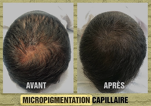 Représentation de la formation : PIGMENTATION CAPILLAIRE (trichopigmentation ou micropigmentation capillaire)