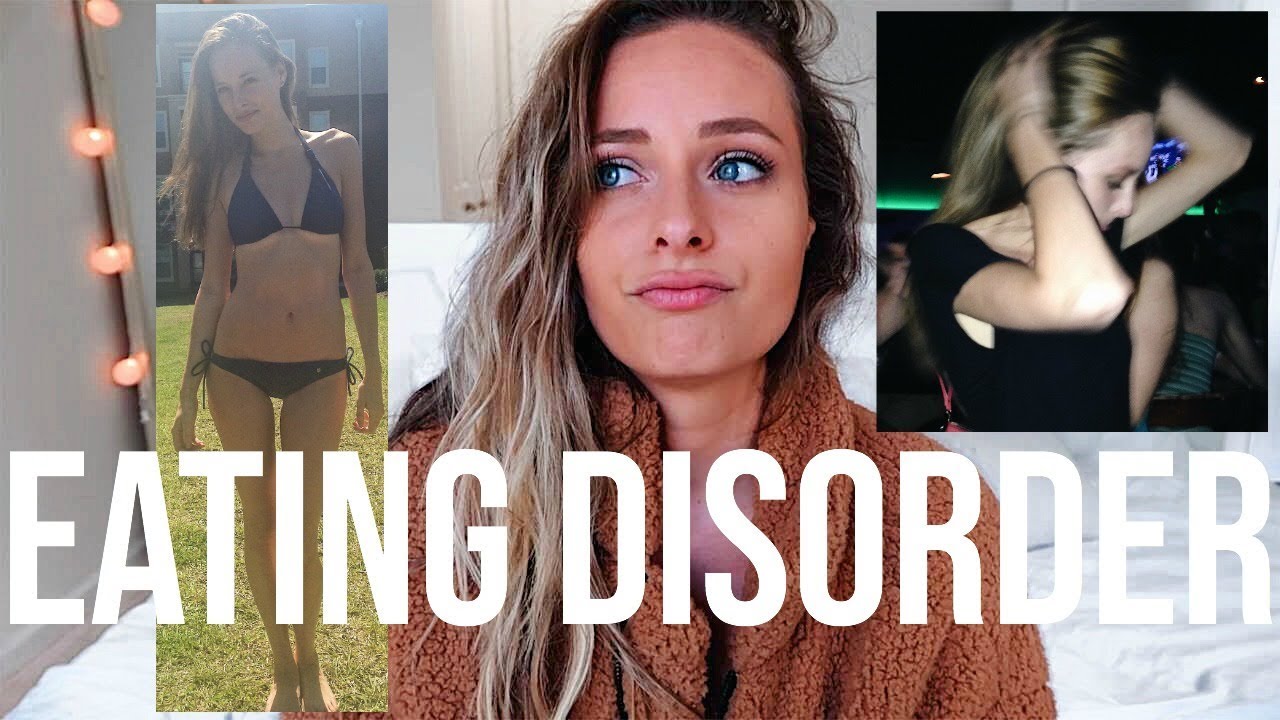 Eating Disorders -