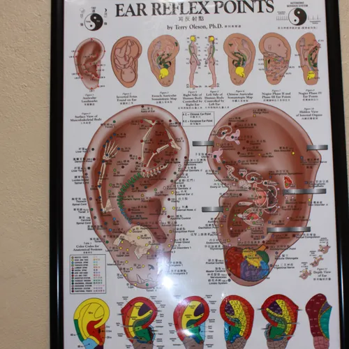 AuriculoTherapy