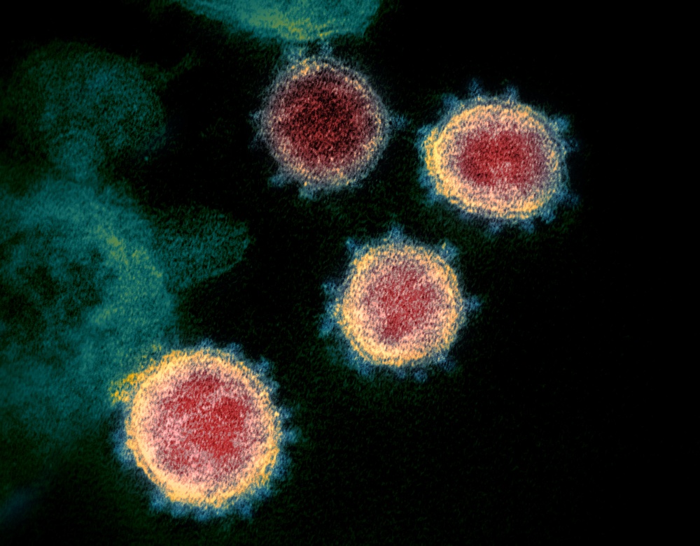 Bild från microskop på coronavirus i rött och blågrönt mot svart bakgrund.