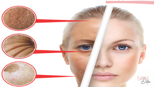 Représentation de la formation : FORMATION MICRONEEDLING EN LIGNE