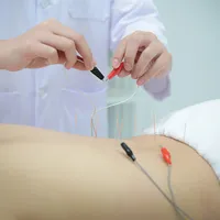 Electro Acupuncture- Follow up