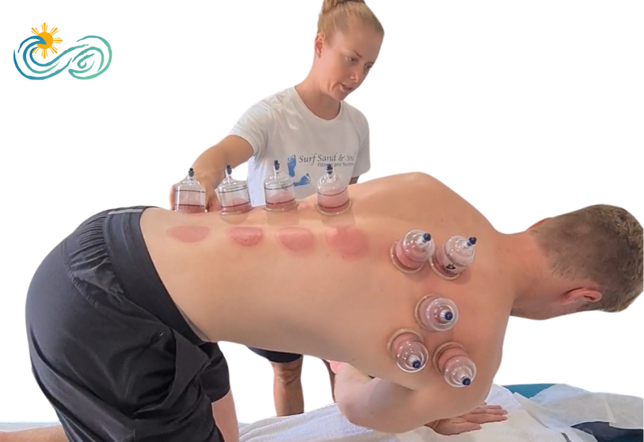 Modern Cupping Techniques