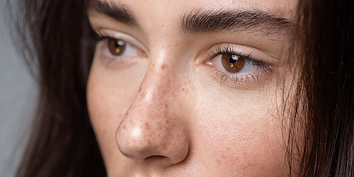 Représentation de la formation : S Taches de Rousseur et Grains de Beauté 