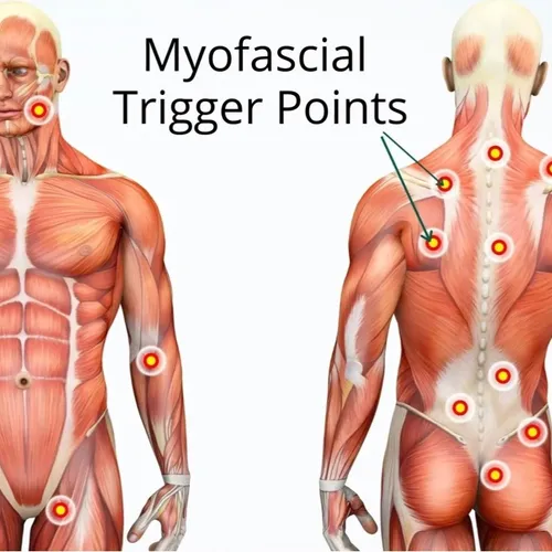 Myofascial & Trigger Point work