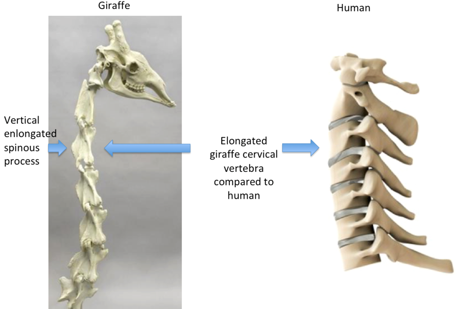 Bones come. Жираф ключица. Жираф и остеохондроз. Megalosaurus vertebrae. Neck Bone on a person.