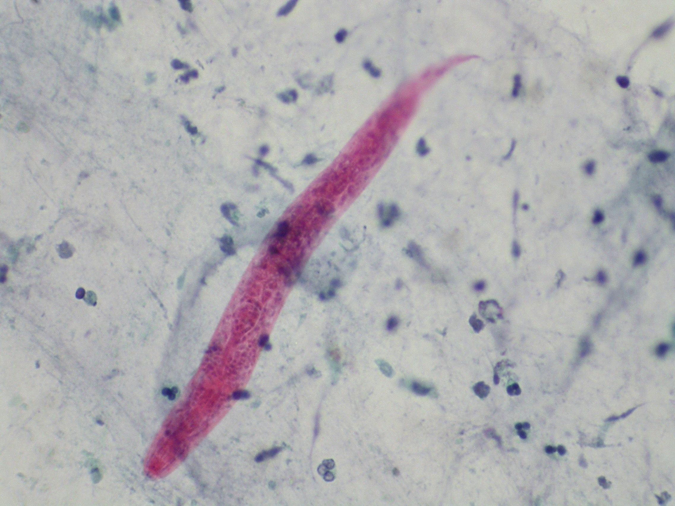 parasite under microscope ivermectin covid worms