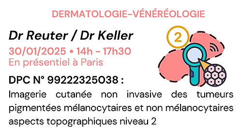 Représentation de la formation : Imagerie cutanée non invasive des tumeurs pigmentées : aspects topographiques niveau 2 - DPC - N°99222325038