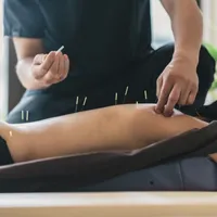 Acupuncture Therapy, 1 hr