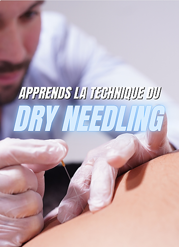 Représentation de la formation : Formation Dry Needling par Thibault Dracius