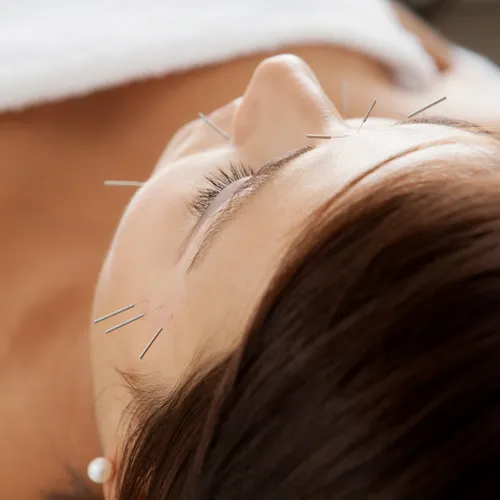 Acupuncture Facial Rejuvenation