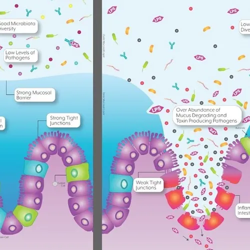 IBS Restoration