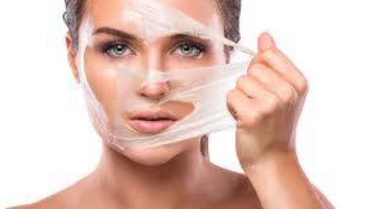 Représentation de la formation : Formation peeling