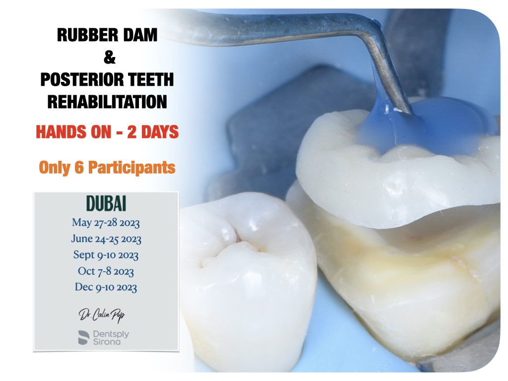 RUBBER DAM AND POSTERIOR TEETH REHABILITATION | DR. CALIN POP ONLINE