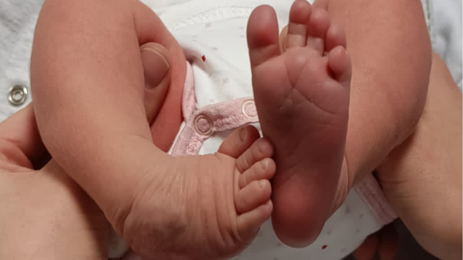 Représentation de la formation : Malpositions et malformations du pied du nourrisson : diagnostic et prise en charge