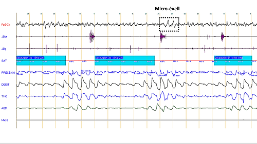 Lecture Polysomnographie PSG