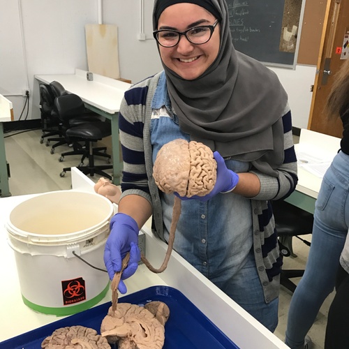 This was the first time I ever held a human brain and spinal cord before. It was an amazing experience!