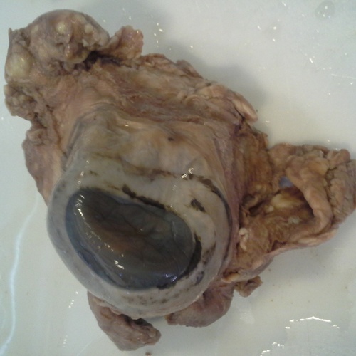 The Cow Eye that I got to dissect