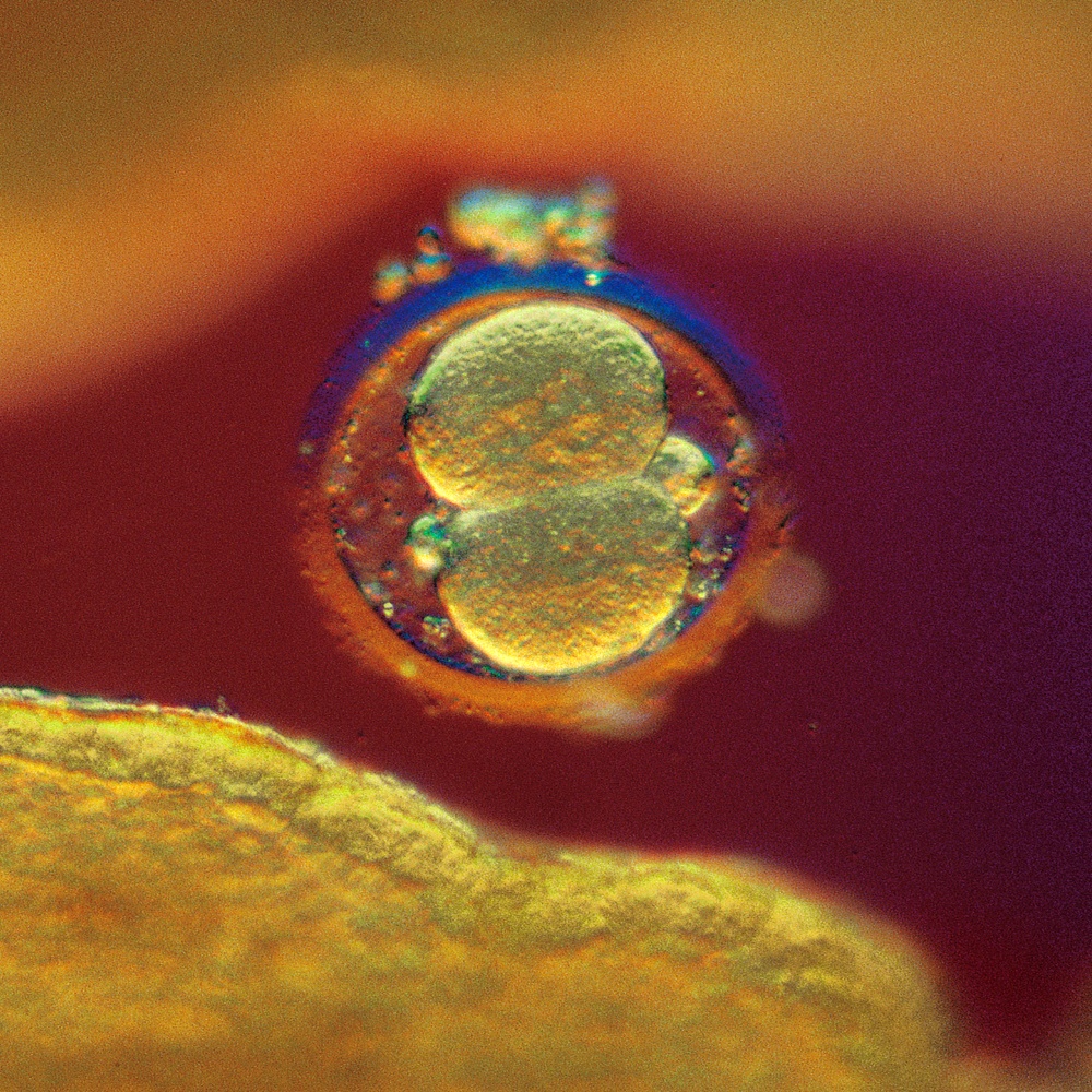 Första celldelningen
Ägget 1 dygn efter befruktningen. Det befruktade ägget har börjat dela sig.
1990, ljusmikroskopi.
©Lennart Nilsson/TT Nyhetsbyrån

