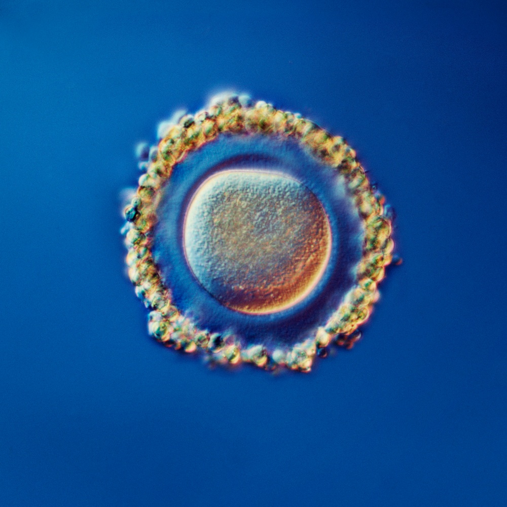 Ägg med hormonkörtel runt
Äggcellen omgiven av näringsceller som framstår som en lysande krans, “corona radiata”. 
1973, ljusmikroskopi.
©Lennart Nilsson/TT Nyhetsbyrån
