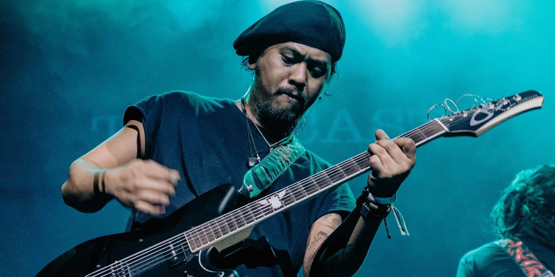 Steve Badiola of Typecast shares update on hit-and-run accident, knee surgery