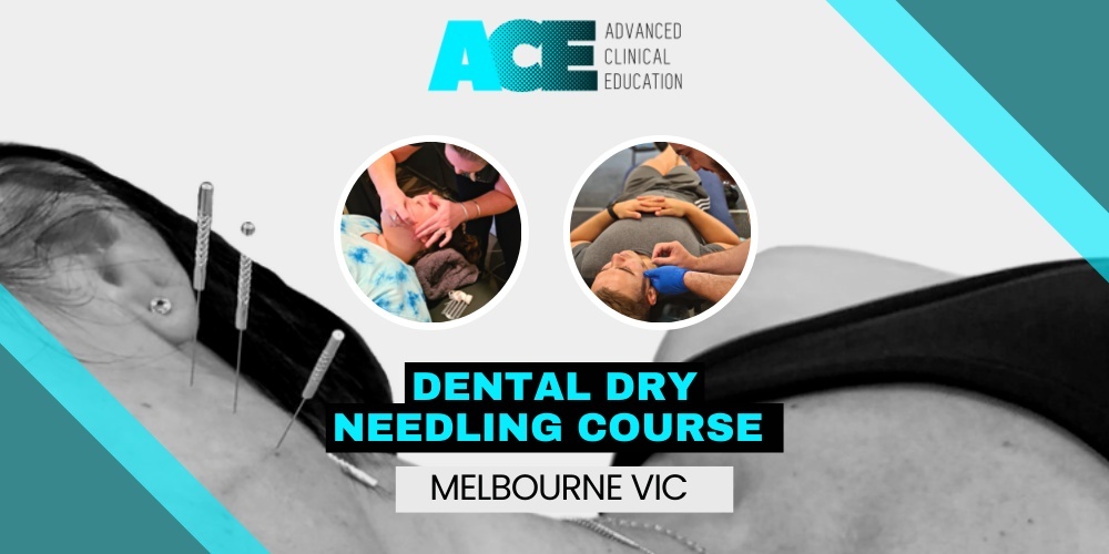 Dental Dry Needling Course (Melbourne VIC)