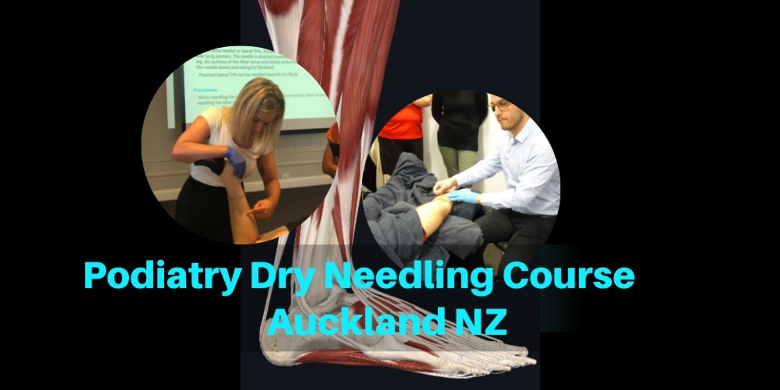 Banner image for Podiatry Dry Needling Course (Auckland NZ)