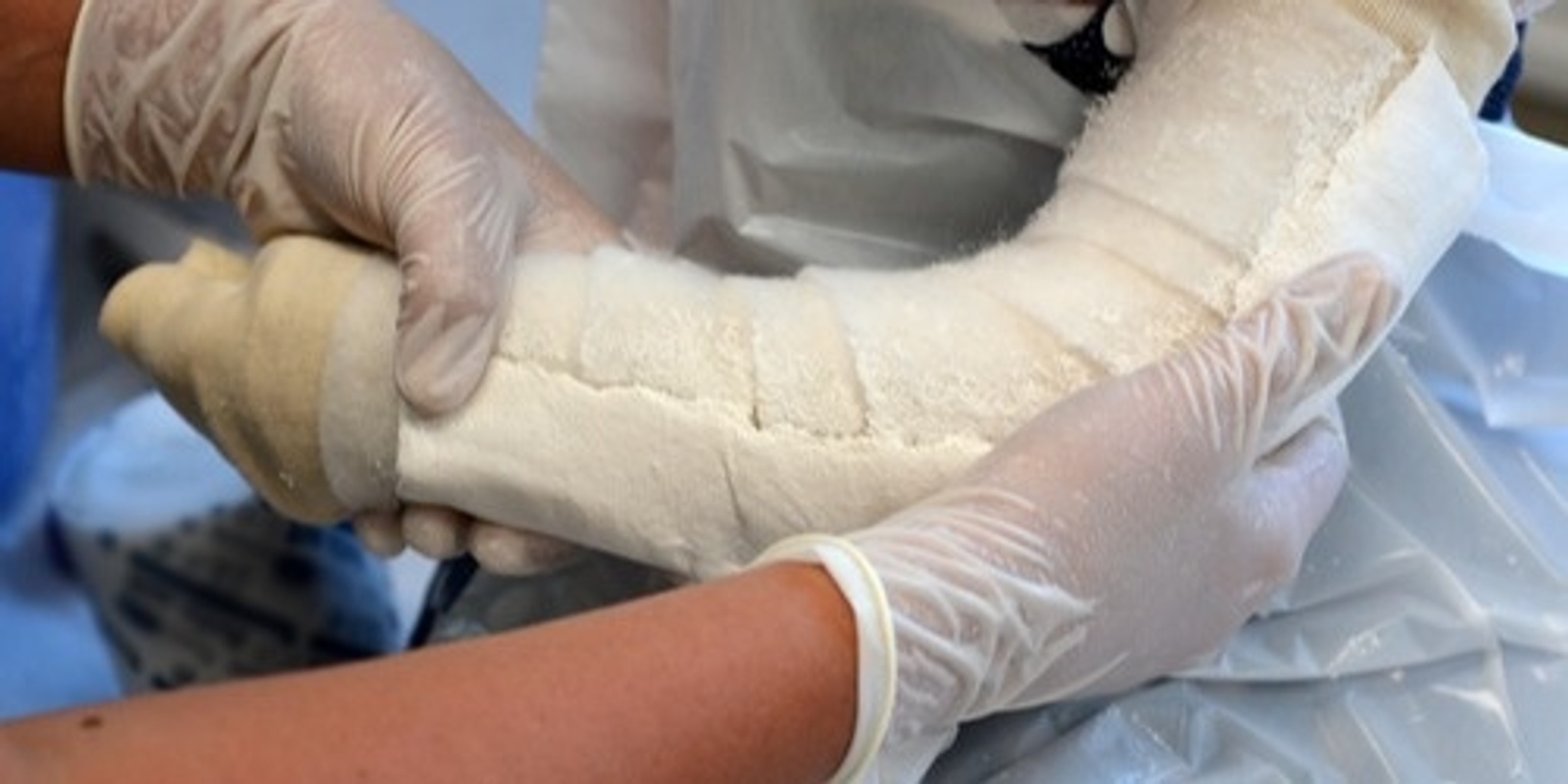 Banner image for Emergency Plaster Splinting and Fracture Management