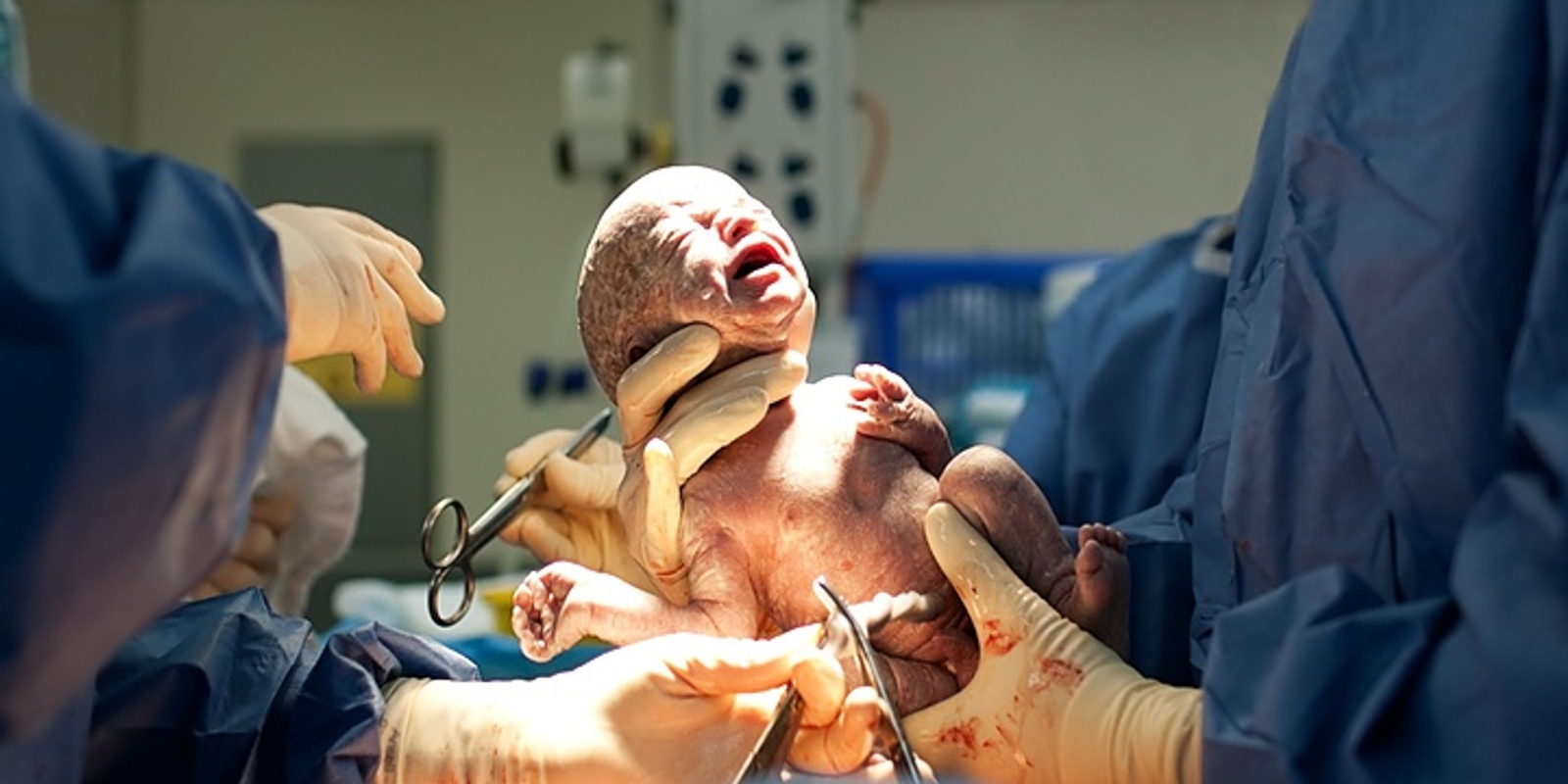 Banner image for Crisis Management in Obstetric Anaesthesia and Neonatal Resuscitation (CMOANR)