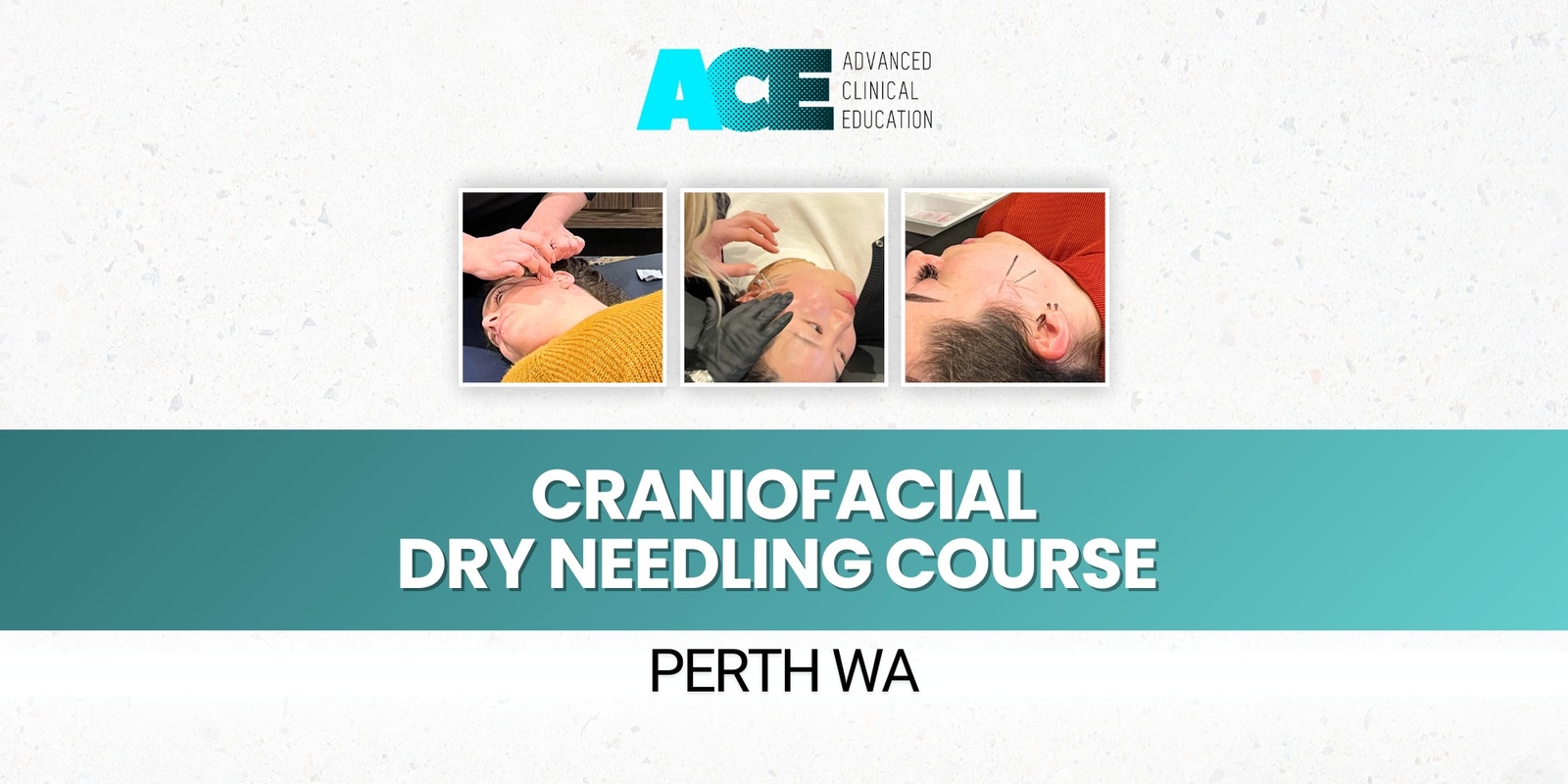 Banner image for Craniofacial Dry Needling Course (Perth WA)