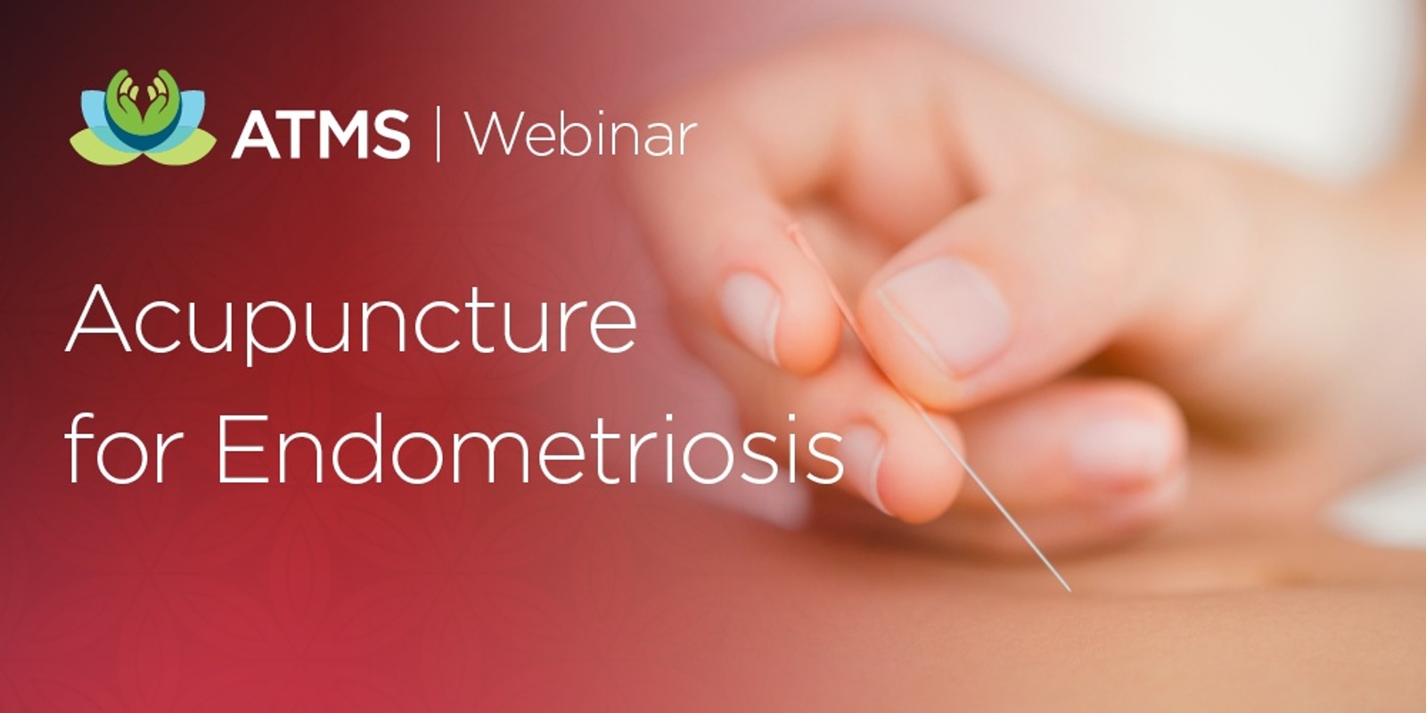 Webinar Recording: Endometriosis & the Inflammatory Trail- The Role of Acupuncture in Treatment