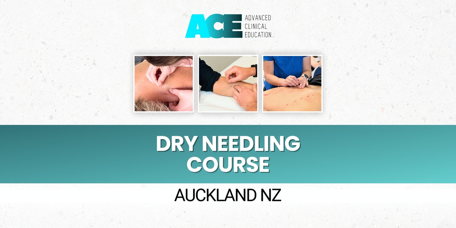 Banner image for Dry Needling Course (Auckland NZ)