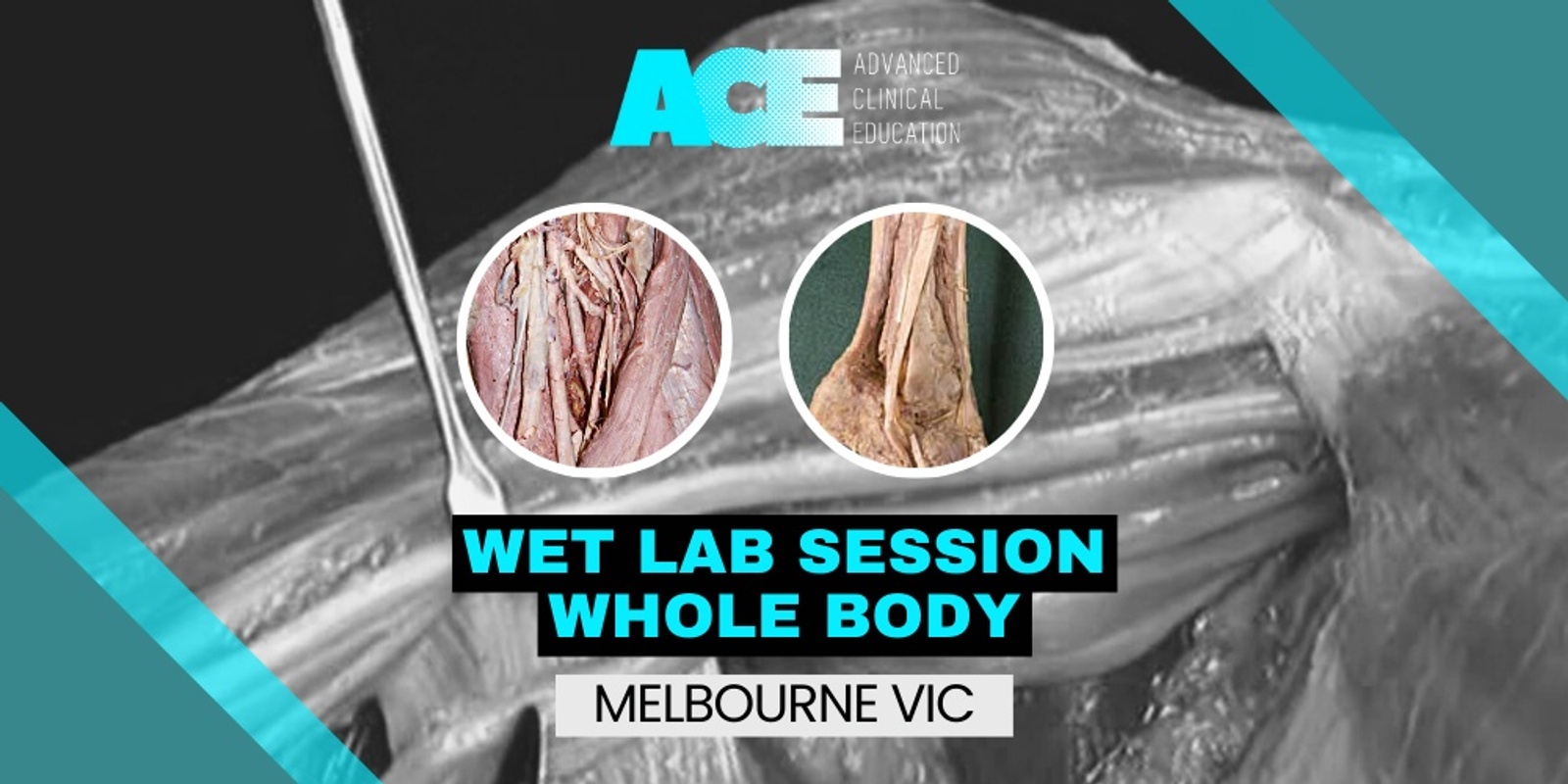 Banner image for Anatomy Wet Lab Session - Whole body (Melbourne VIC)