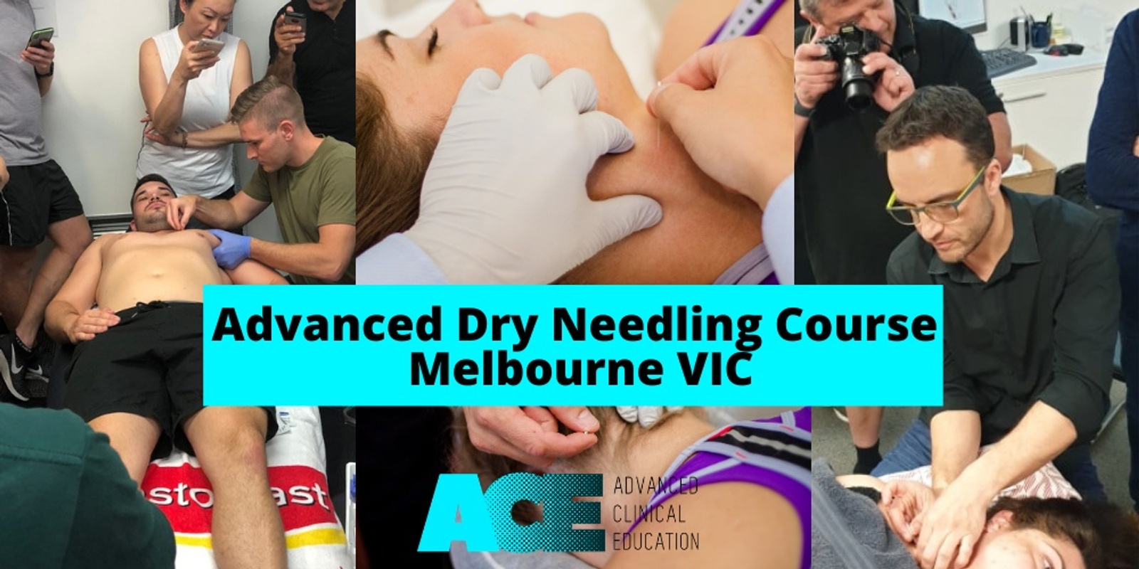 Banner image for Advanced Dry Needling Course (Melbourne VIC)