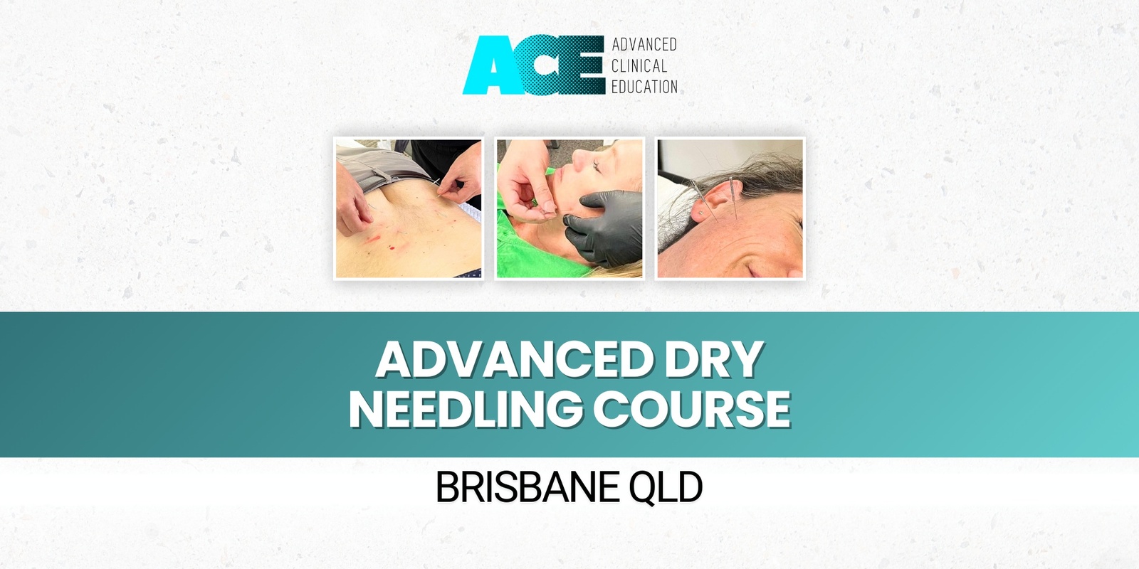 Banner image for Advanced Dry Needling Course (Brisbane QLD)