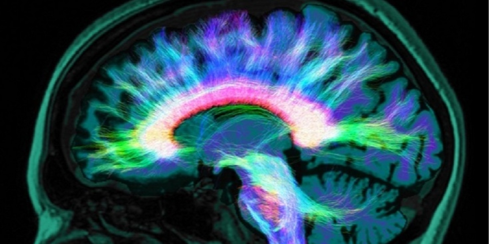 Banner image for Changing the World with Magnetic Resonance Imaging