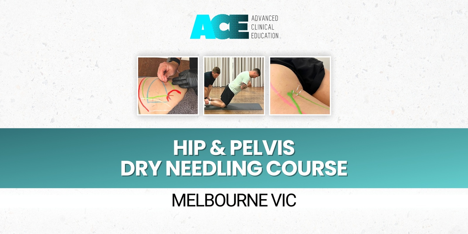 Banner image for Hip and Pelvis Dry Needling Course (Melbourne VIC)