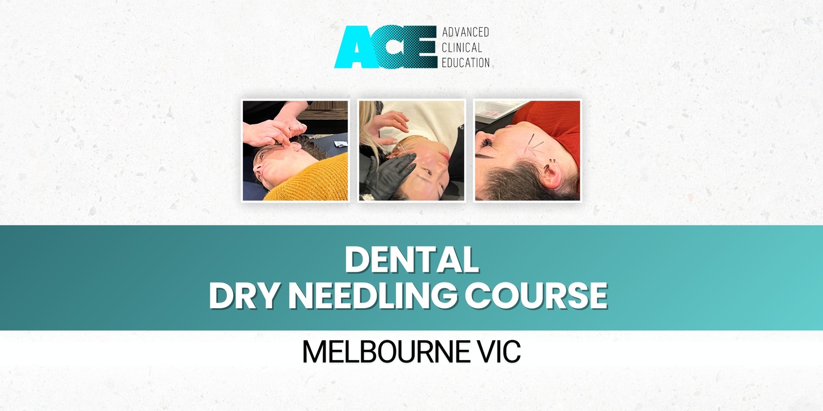 Banner image for Dental Dry Needling Course (Melbourne VIC)