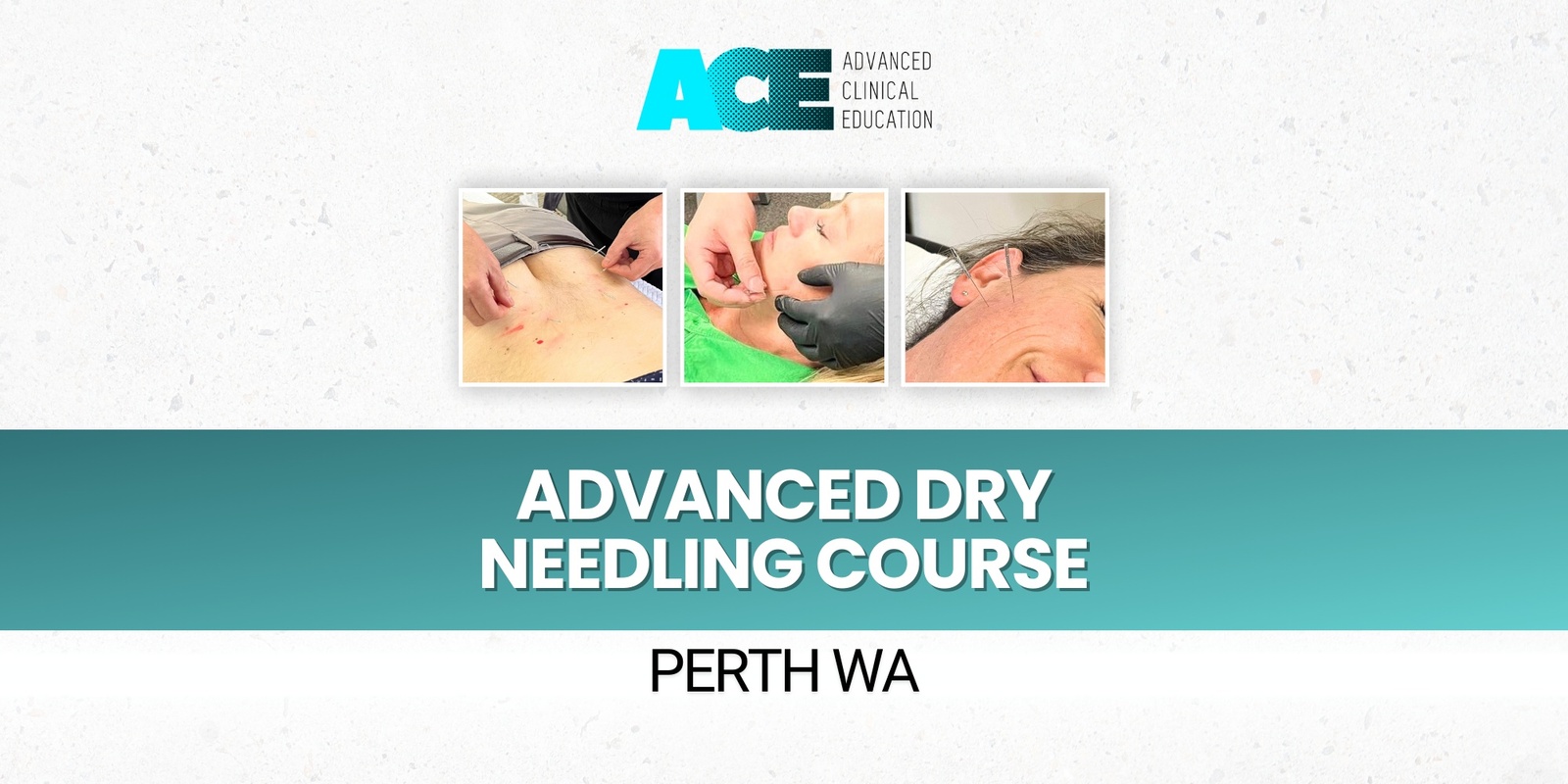 Banner image for Advanced Dry Needling Course (Perth WA)