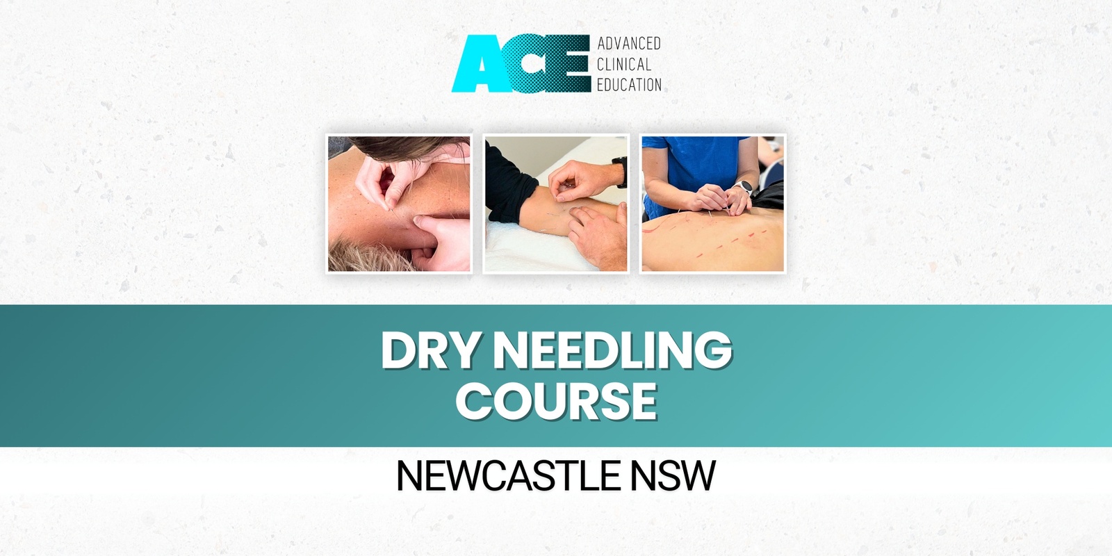 Banner image for Dry Needling Course (Newcastle NSW)