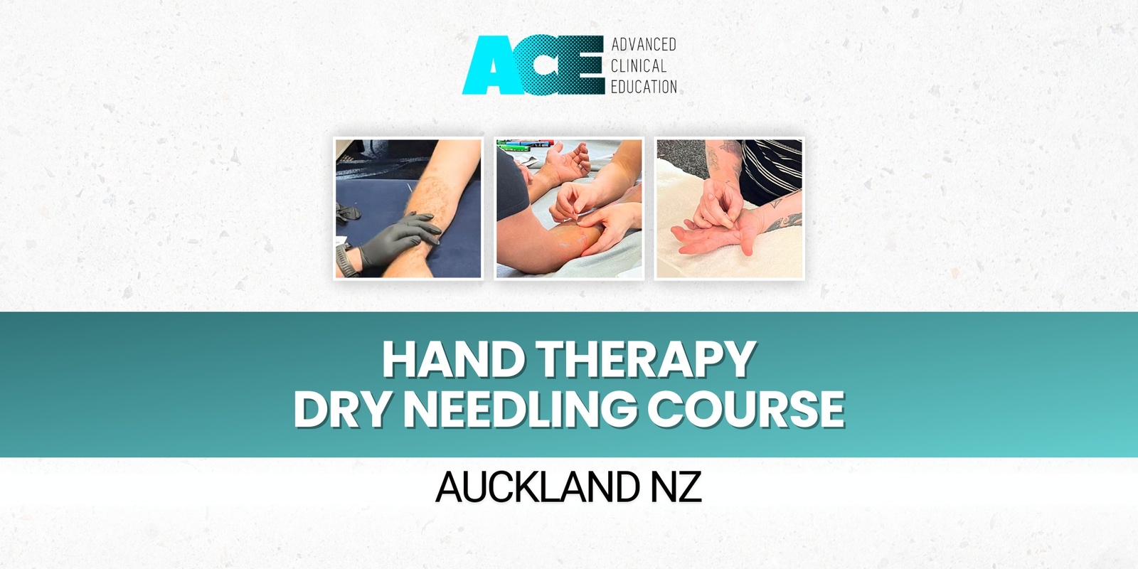 Banner image for Hand Therapy Dry Needling Course (Auckland NZ)