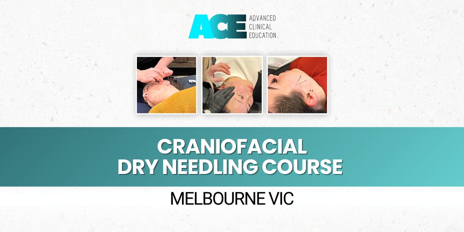 Banner image for Craniofacial Dry Needling Course (Melbourne VIC)