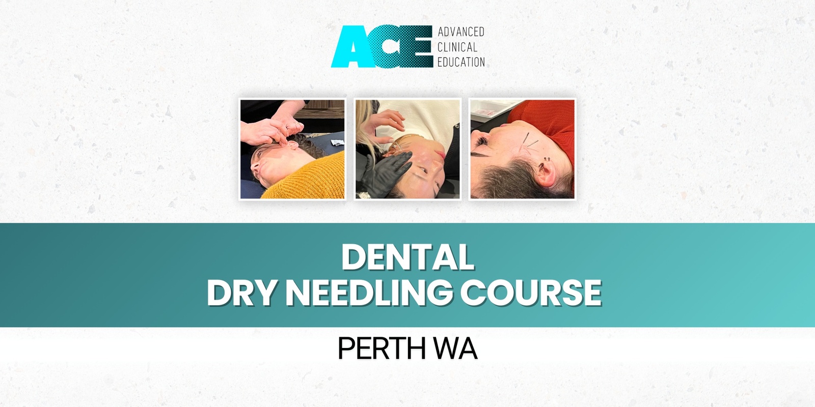 Banner image for Dental Dry Needling Course (Perth WA)