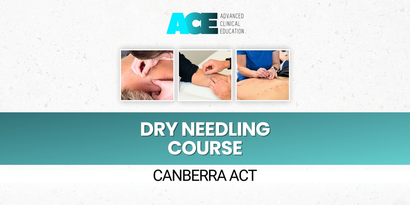 Banner image for Dry Needling Course (Canberra ACT)
