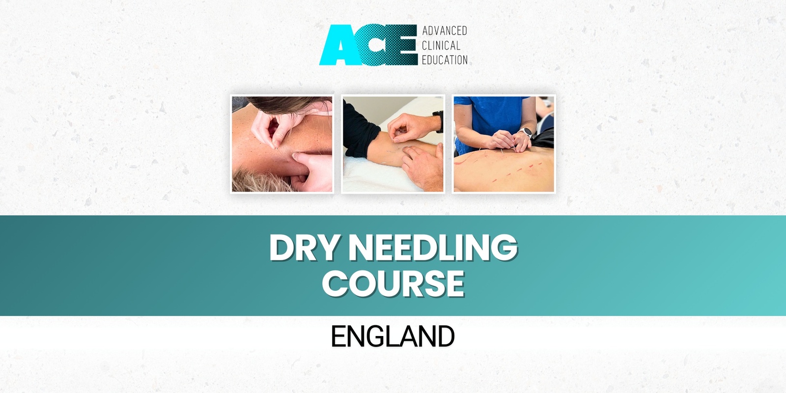 Banner image for Dry Needling Course (England UK)