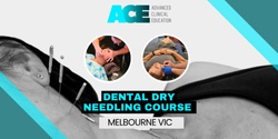 Banner image for Dental Dry Needling Course (Melbourne VIC)