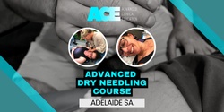 Advanced Dry Needling Course (Adelaide SA)