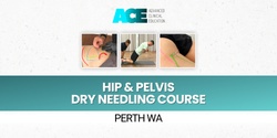 Banner image for Hip and Pelvis Dry Needling Course (Perth WA)