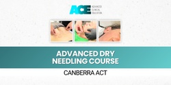 Banner image for Advanced Dry Needling Course (Canberra ACT)